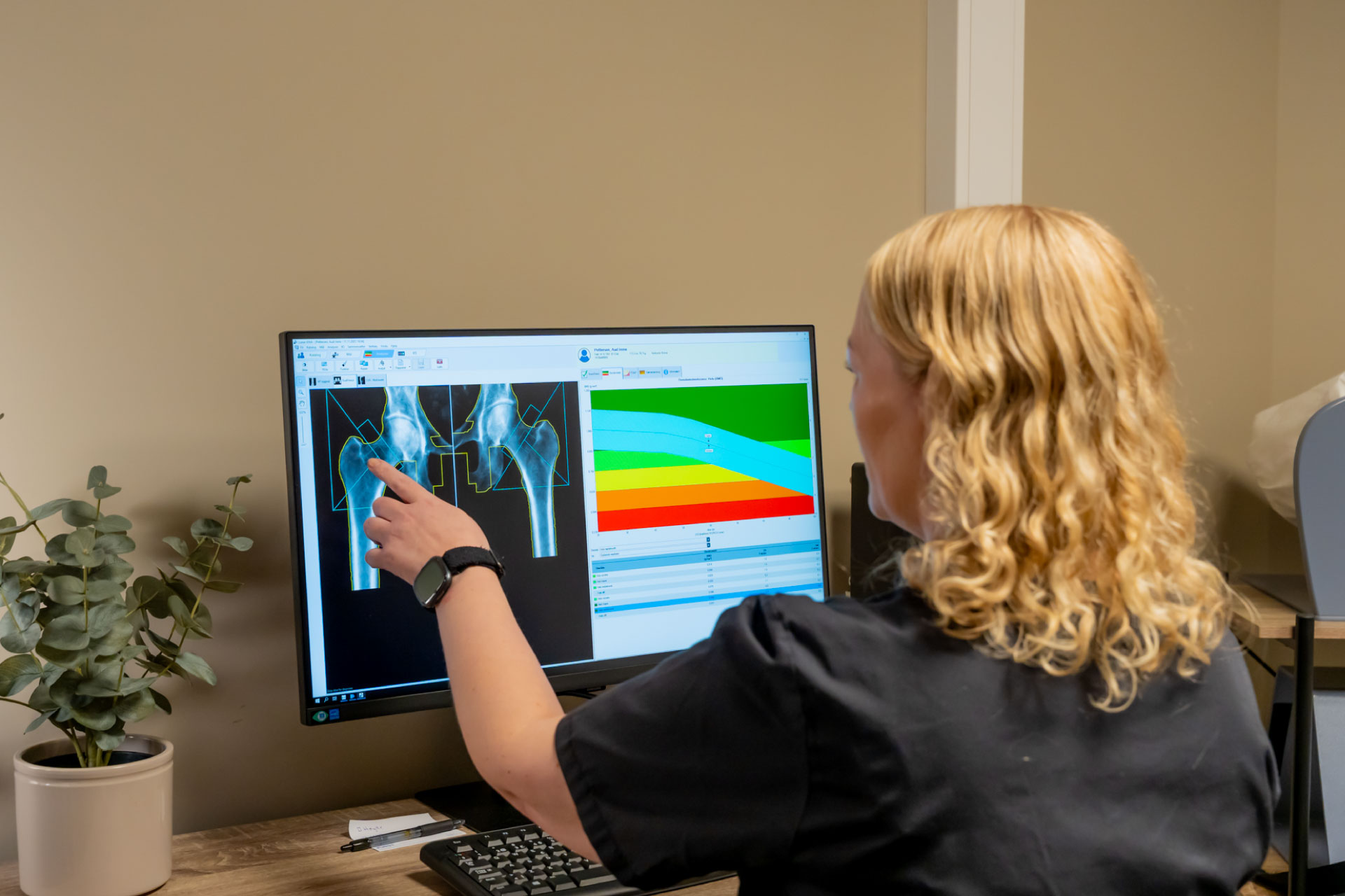 Medisinsk sekretær ser på resultater etter en benhelseundersøkelse, etter en DEXA-scan