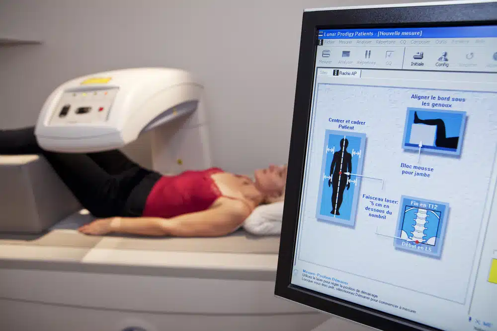 En dataskjerm som viser illustrasjoner av hvordan DEXA-scan skal utføres. I bakgrunnen ligger en pasient under DEXA-maskinen med beina hevet